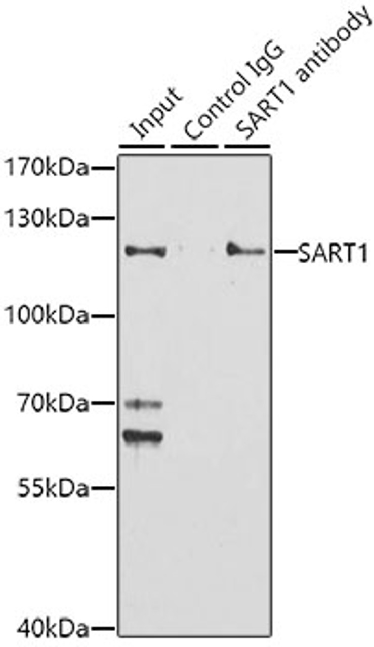Immunoprecipitation analysis of 150ug extracts of Jurkat cells using 3ug SART1 antibody (23-663) . Western blot was performed from the immunoprecipitate using SART1 antibody (23-663) at a dilition of 1:1000.