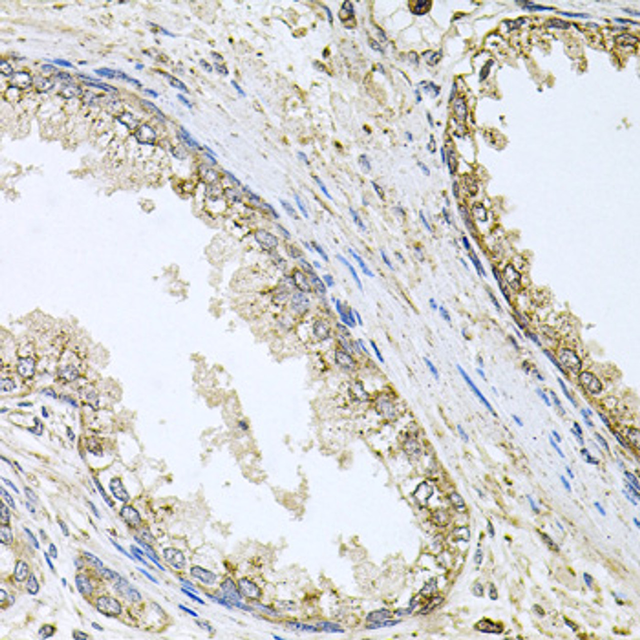 Immunohistochemistry of paraffin-embedded human prostate using CYP46A1 antibody (23-667) at dilution of 1:100 (40x lens) .