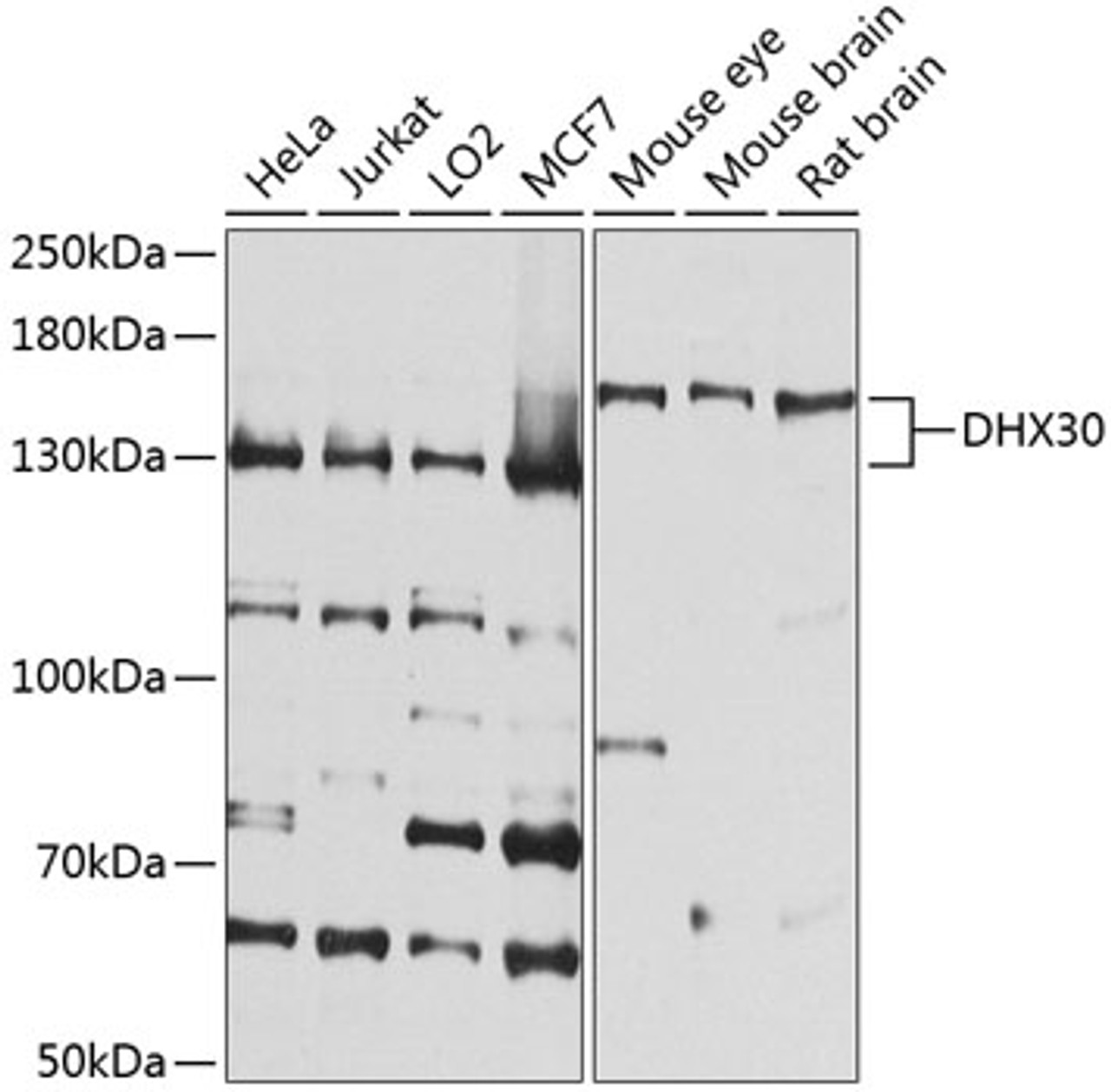 Western blot analysis of extracts of various cell lines, using DHX30 antibody (23-669) at 1:1000 dilution.<br/>Secondary antibody: HRP Goat Anti-Rabbit IgG (H+L) at 1:10000 dilution.<br/>Lysates/proteins: 25ug per lane.<br/>Blocking buffer: 3% nonfat dry milk in TBST.<br/>Detection: ECL Basic Kit.<br/>Exposure time: 30s.