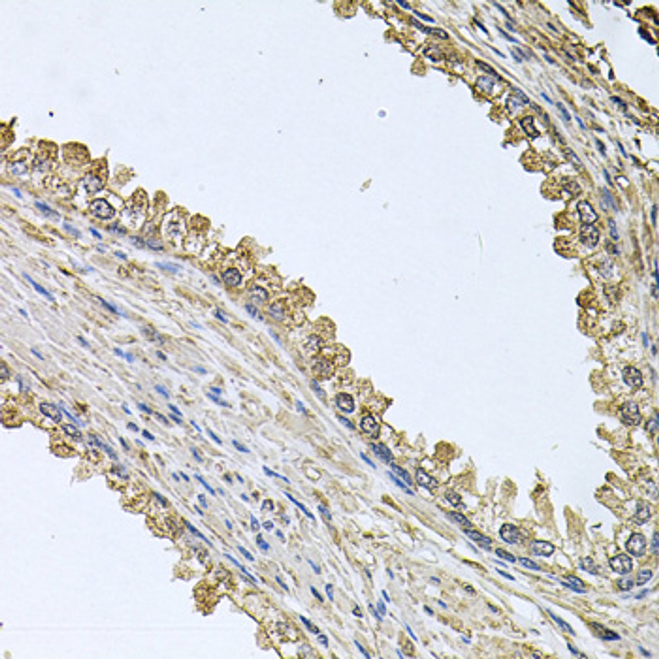 Immunohistochemistry of paraffin-embedded human prostate using MEMO1 antibody (23-671) at dilution of 1:100 (40x lens) .