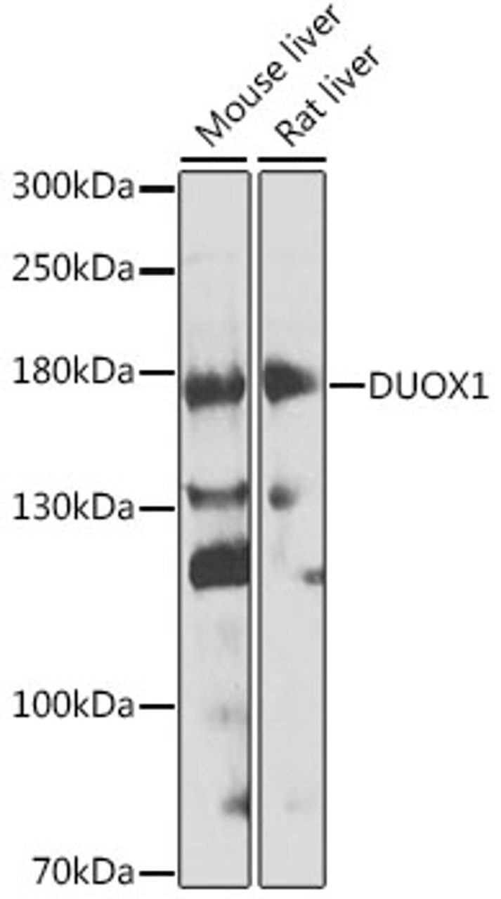 Western blot analysis of extracts of various cell lines, using DUOX1 antibody (23-672) at 1:1000 dilution.<br/>Secondary antibody: HRP Goat Anti-Rabbit IgG (H+L) at 1:10000 dilution.<br/>Lysates/proteins: 25ug per lane.<br/>Blocking buffer: 3% nonfat dry milk in TBST.<br/>Detection: ECL Enhanced Kit.<br/>Exposure time: 60s.