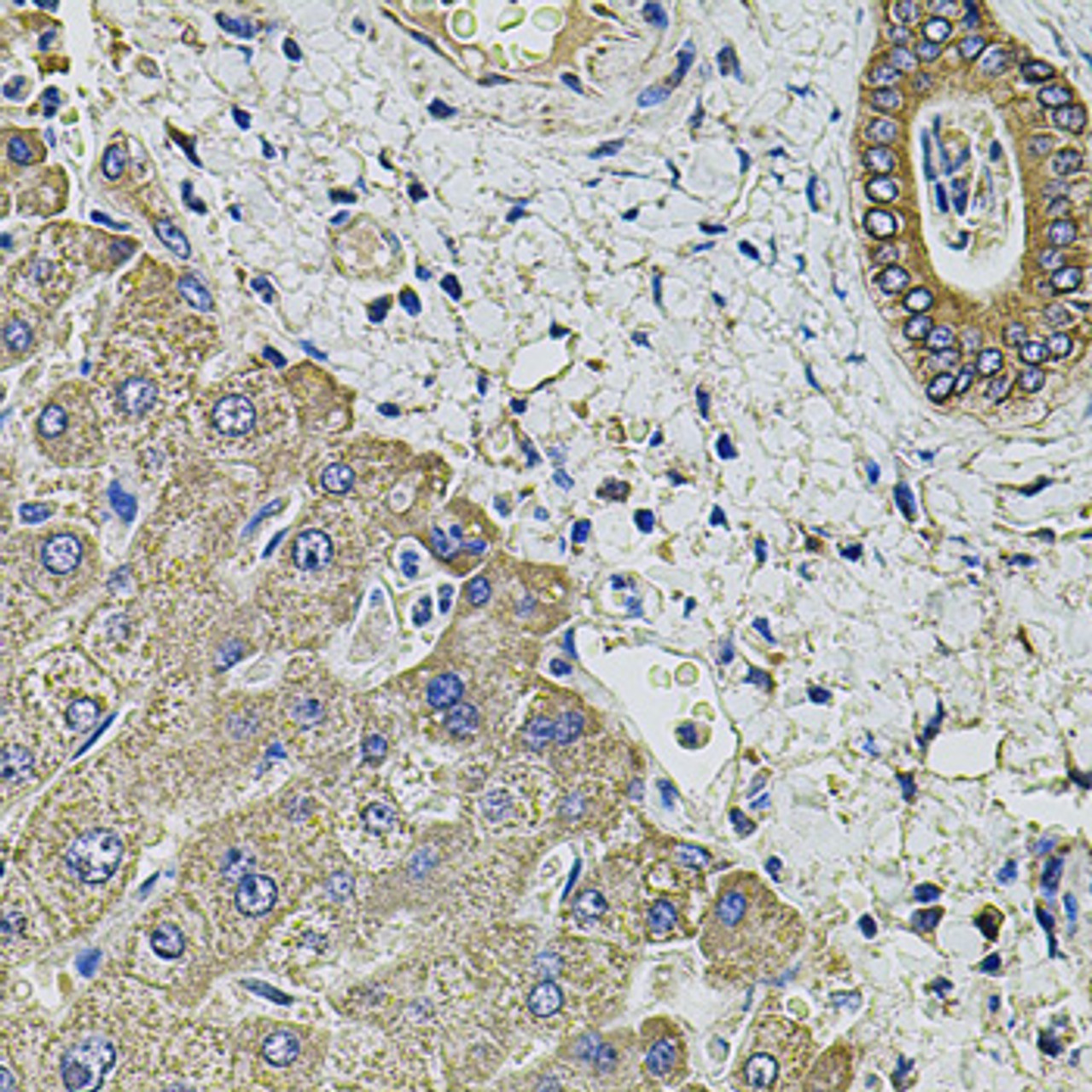 Immunohistochemistry of paraffin-embedded human liver damage using KCNK9 antibody (23-688) at dilution of 1:100 (40x lens) .
