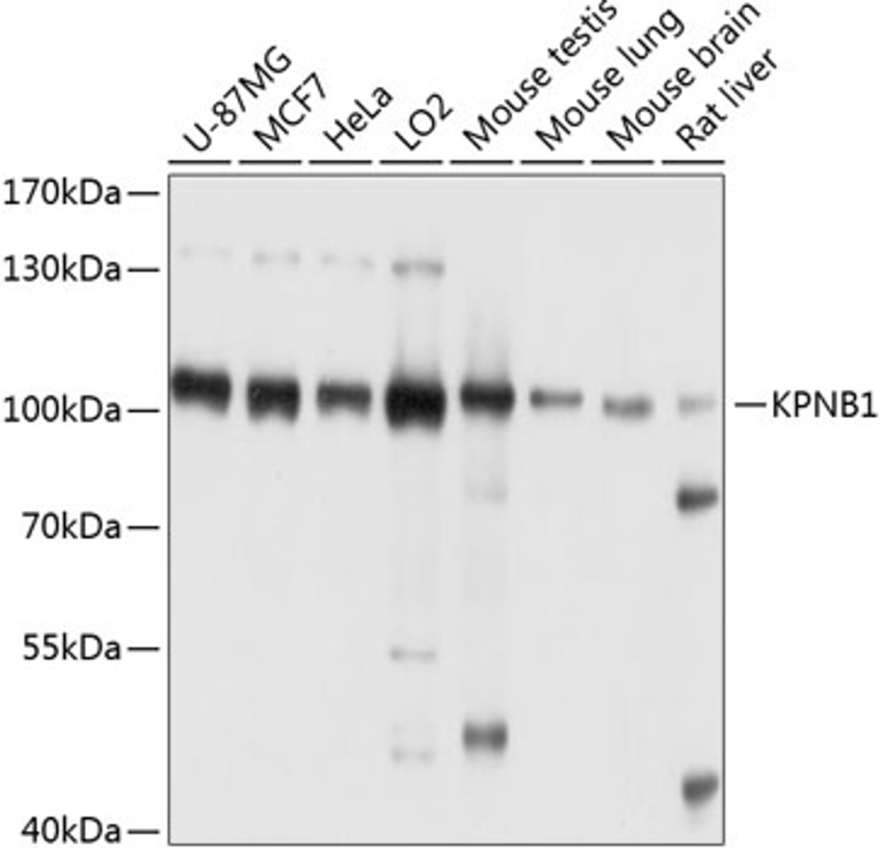 Western blot analysis of extracts of various cell lines, using KPNB1 antibody (23-689) at 1:1000 dilution.<br/>Secondary antibody: HRP Goat Anti-Rabbit IgG (H+L) at 1:10000 dilution.<br/>Lysates/proteins: 25ug per lane.<br/>Blocking buffer: 3% nonfat dry milk in TBST.<br/>Detection: ECL Basic Kit.<br/>Exposure time: 30s.