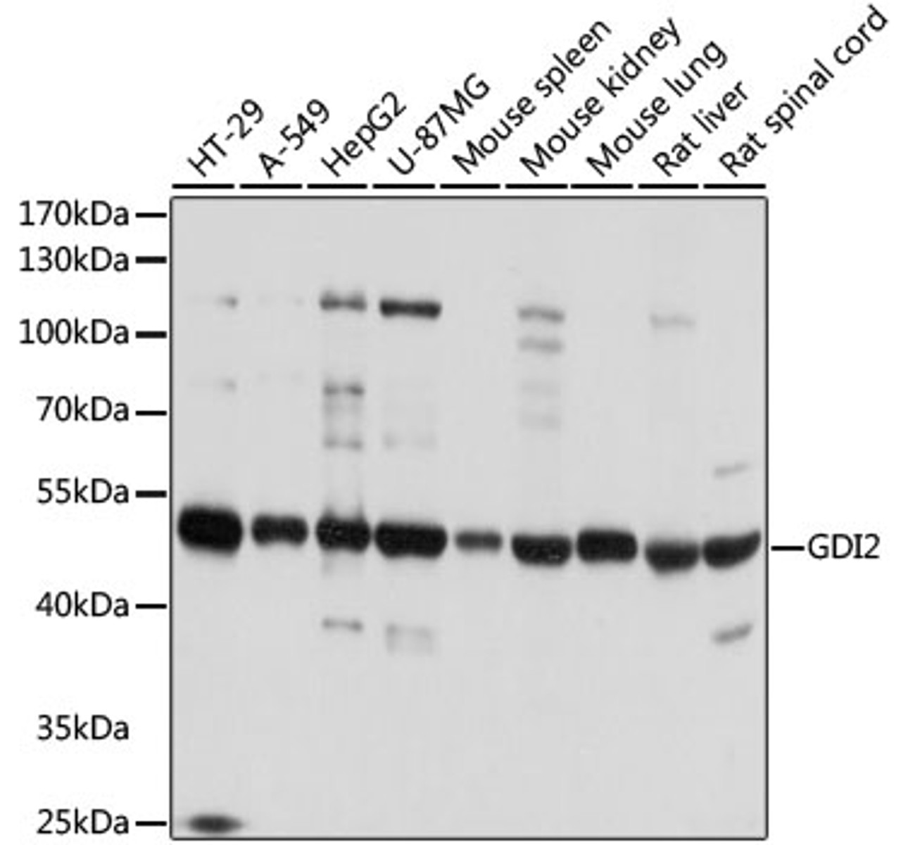 Western blot analysis of extracts of various cell lines, using GDI2 antibody (23-690) at 1:1000 dilution.<br/>Secondary antibody: HRP Goat Anti-Rabbit IgG (H+L) at 1:10000 dilution.<br/>Lysates/proteins: 25ug per lane.<br/>Blocking buffer: 3% nonfat dry milk in TBST.<br/>Detection: ECL Basic Kit.<br/>Exposure time: 1s.