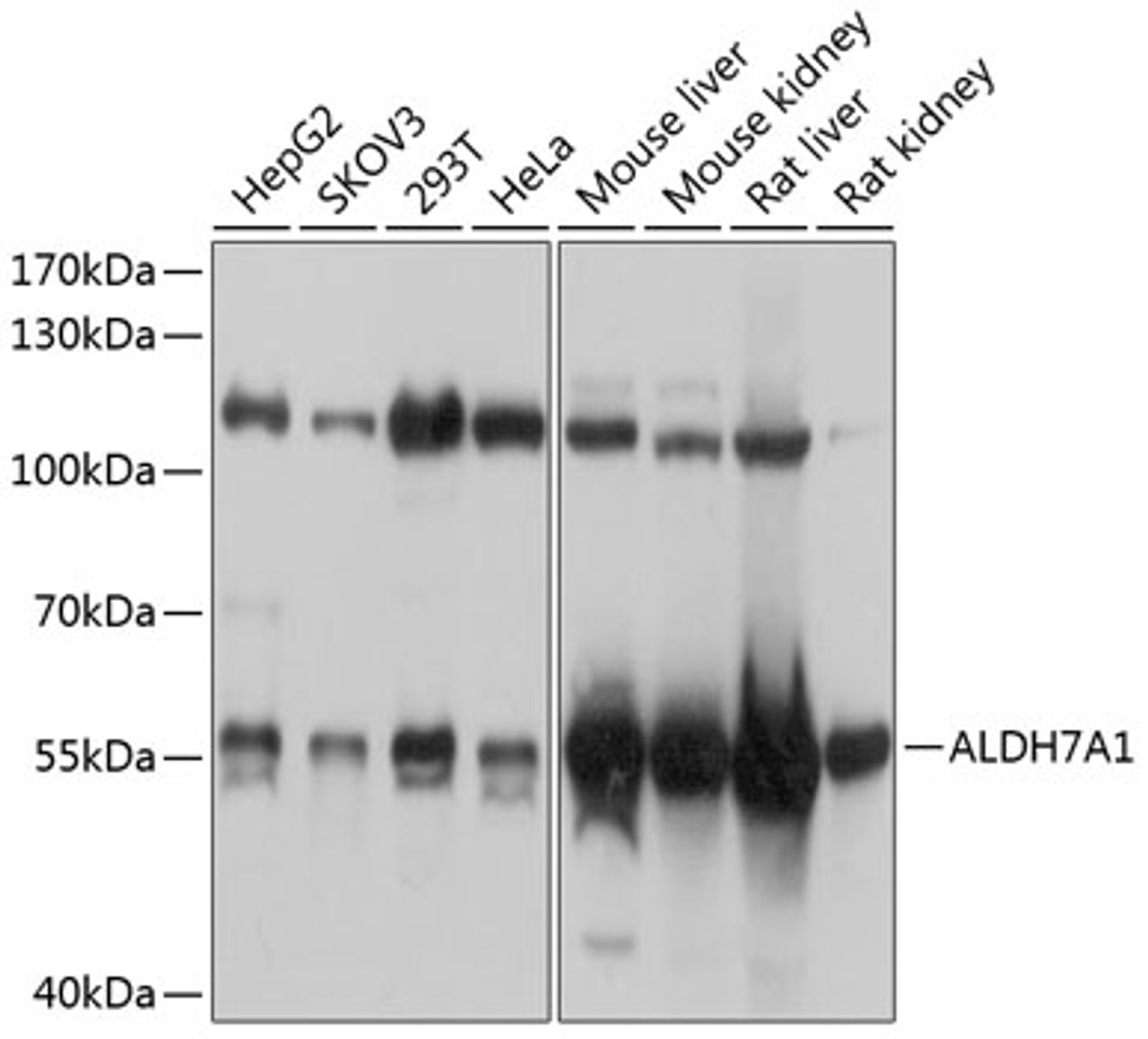 Western blot analysis of extracts of various cell lines, using ALDH7A1 antibody (23-693) at 1:1000 dilution.<br/>Secondary antibody: HRP Goat Anti-Rabbit IgG (H+L) at 1:10000 dilution.<br/>Lysates/proteins: 25ug per lane.<br/>Blocking buffer: 3% nonfat dry milk in TBST.<br/>Detection: ECL Basic Kit.<br/>Exposure time: 1s.