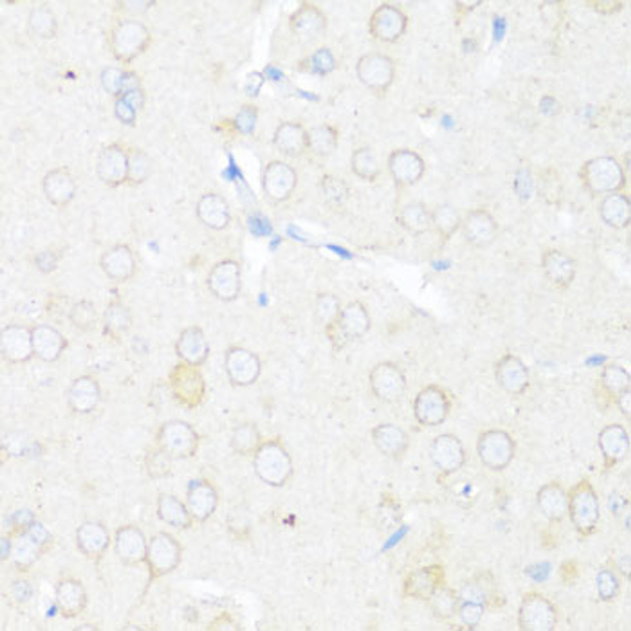 Immunohistochemistry of paraffin-embedded rat brain using EIF3J antibody (23-694) at dilution of 1:100 (40x lens) .