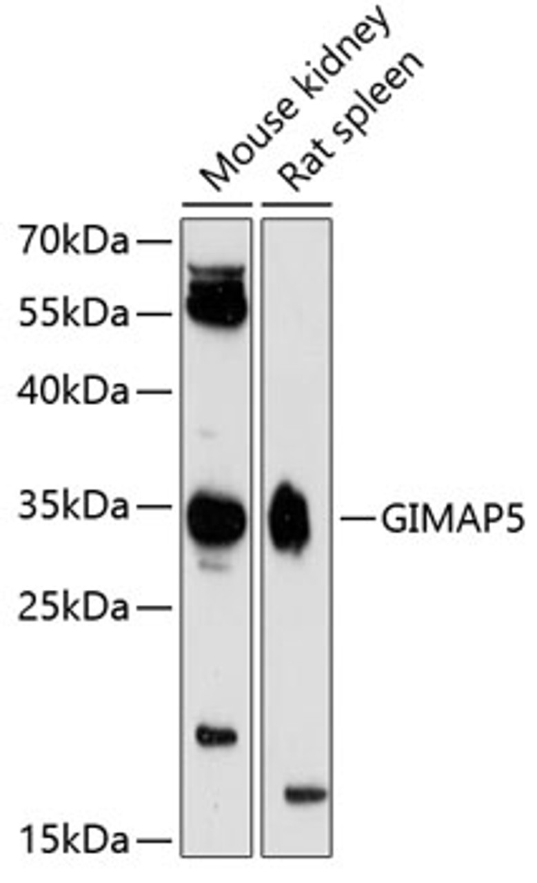 Western blot analysis of extracts of various cell lines, using GIMAP5 antibody (23-703) at 1:3000 dilution.<br/>Secondary antibody: HRP Goat Anti-Rabbit IgG (H+L) at 1:10000 dilution.<br/>Lysates/proteins: 25ug per lane.<br/>Blocking buffer: 3% nonfat dry milk in TBST.<br/>Detection: ECL Enhanced Kit.<br/>Exposure time: 90s.