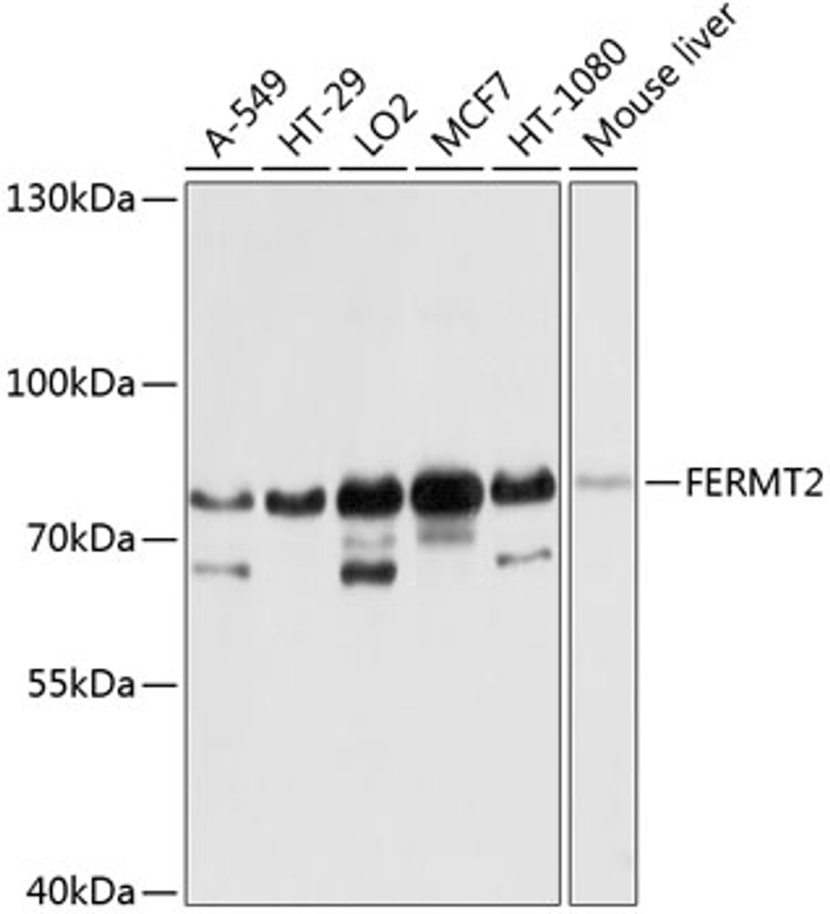 Western blot analysis of extracts of various cell lines, using FERMT2 antibody (23-705) at 1:1000 dilution.<br/>Secondary antibody: HRP Goat Anti-Rabbit IgG (H+L) at 1:10000 dilution.<br/>Lysates/proteins: 25ug per lane.<br/>Blocking buffer: 3% nonfat dry milk in TBST.<br/>Detection: ECL Basic Kit.<br/>Exposure time: 5s.