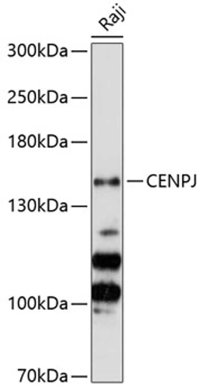 Western blot analysis of extracts of Raji cells, using CENPJ Antibody (23-708) at 1:3000 dilution.<br/>Secondary antibody: HRP Goat Anti-Rabbit IgG (H+L) at 1:10000 dilution.<br/>Lysates/proteins: 25ug per lane.<br/>Blocking buffer: 3% nonfat dry milk in TBST.<br/>Detection: ECL Basic Kit.<br/>Exposure time: 60s.