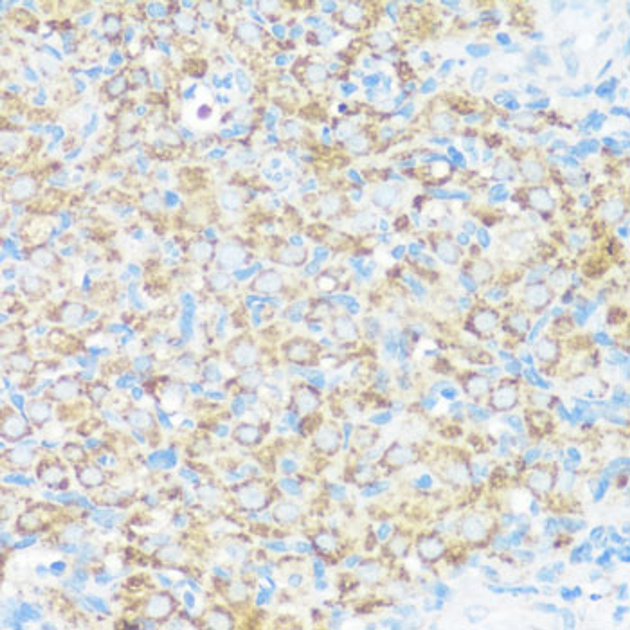 Immunohistochemistry of paraffin-embedded rat ovary using NMT1 antibody (23-709) at dilution of 1:100 (40x lens) .