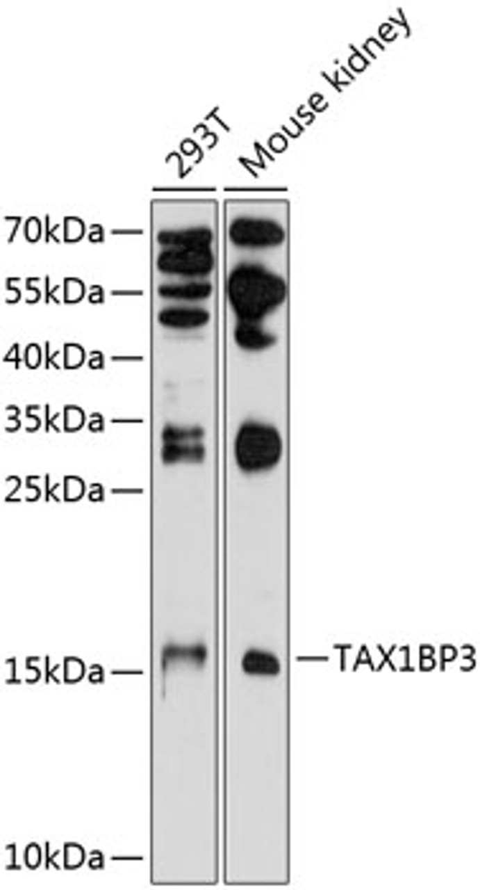 Western blot analysis of extracts of various cell lines, using TAX1BP3 antibody (23-716) at 1:1000 dilution.<br/>Secondary antibody: HRP Goat Anti-Rabbit IgG (H+L) at 1:10000 dilution.<br/>Lysates/proteins: 25ug per lane.<br/>Blocking buffer: 3% nonfat dry milk in TBST.<br/>Detection: ECL Basic Kit.<br/>Exposure time: 90s.