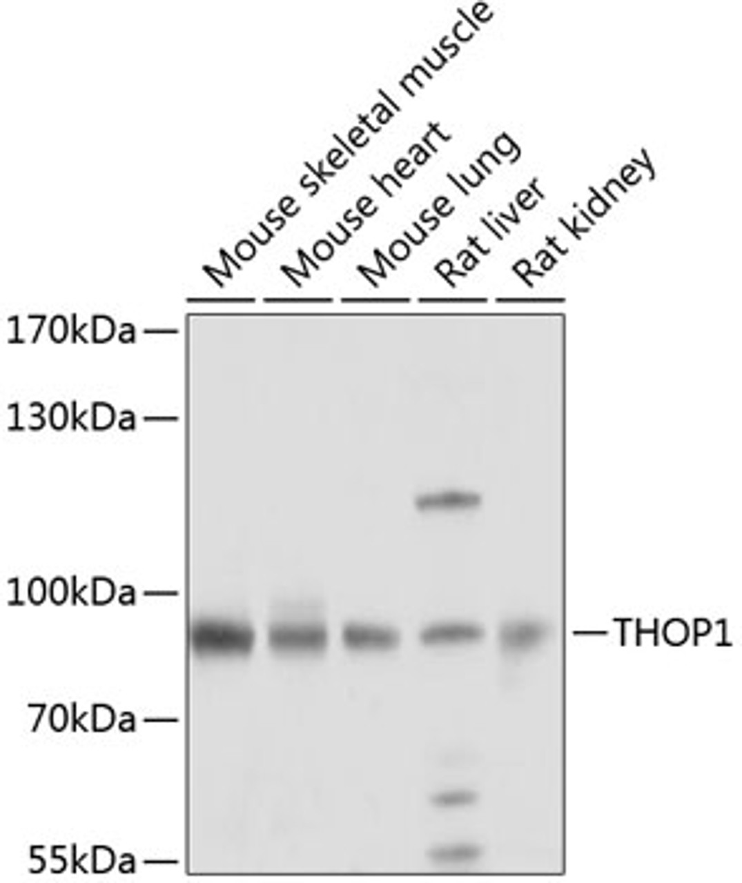 Western blot analysis of extracts of various cell lines, using THOP1 antibody (23-717) at 1:1000 dilution.<br/>Secondary antibody: HRP Goat Anti-Rabbit IgG (H+L) at 1:10000 dilution.<br/>Lysates/proteins: 25ug per lane.<br/>Blocking buffer: 3% nonfat dry milk in TBST.<br/>Detection: ECL Basic Kit.<br/>Exposure time: 5s.