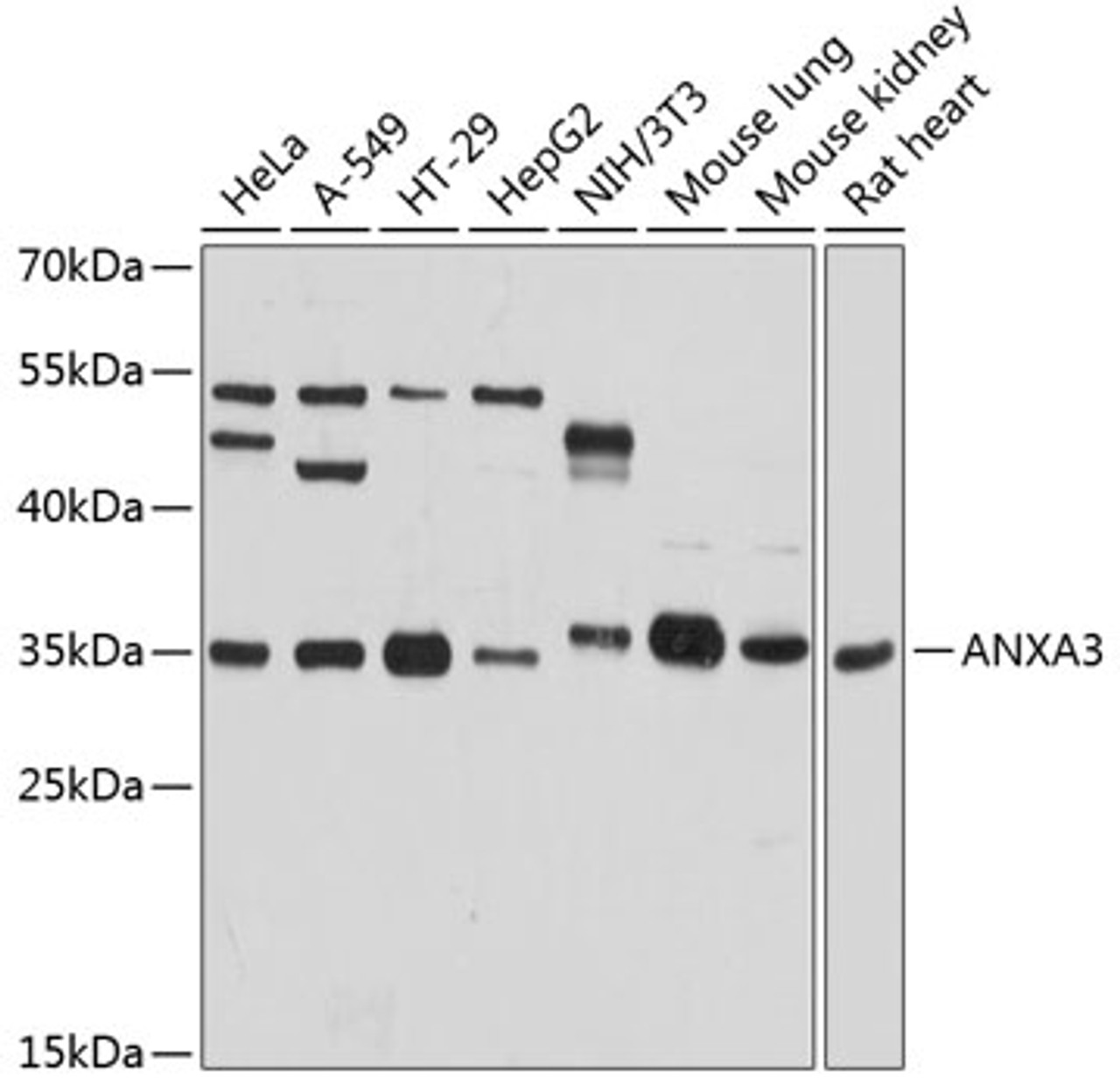 Western blot analysis of extracts of various cell lines, using ANXA3 antibody (23-720) at 1:3000 dilution.<br/>Secondary antibody: HRP Goat Anti-Rabbit IgG (H+L) at 1:10000 dilution.<br/>Lysates/proteins: 25ug per lane.<br/>Blocking buffer: 3% nonfat dry milk in TBST.<br/>Detection: ECL Basic Kit.<br/>Exposure time: 3s.