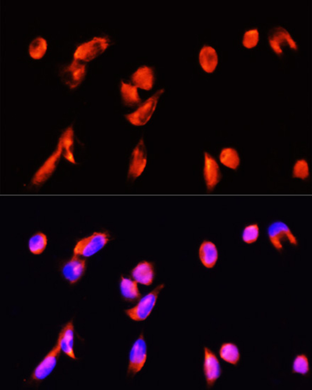 Immunofluorescence analysis of HeLa cells using ANXA3 antibody (23-720) at dilution of 1:100 (40x lens) . Blue: DAPI for nuclear staining.