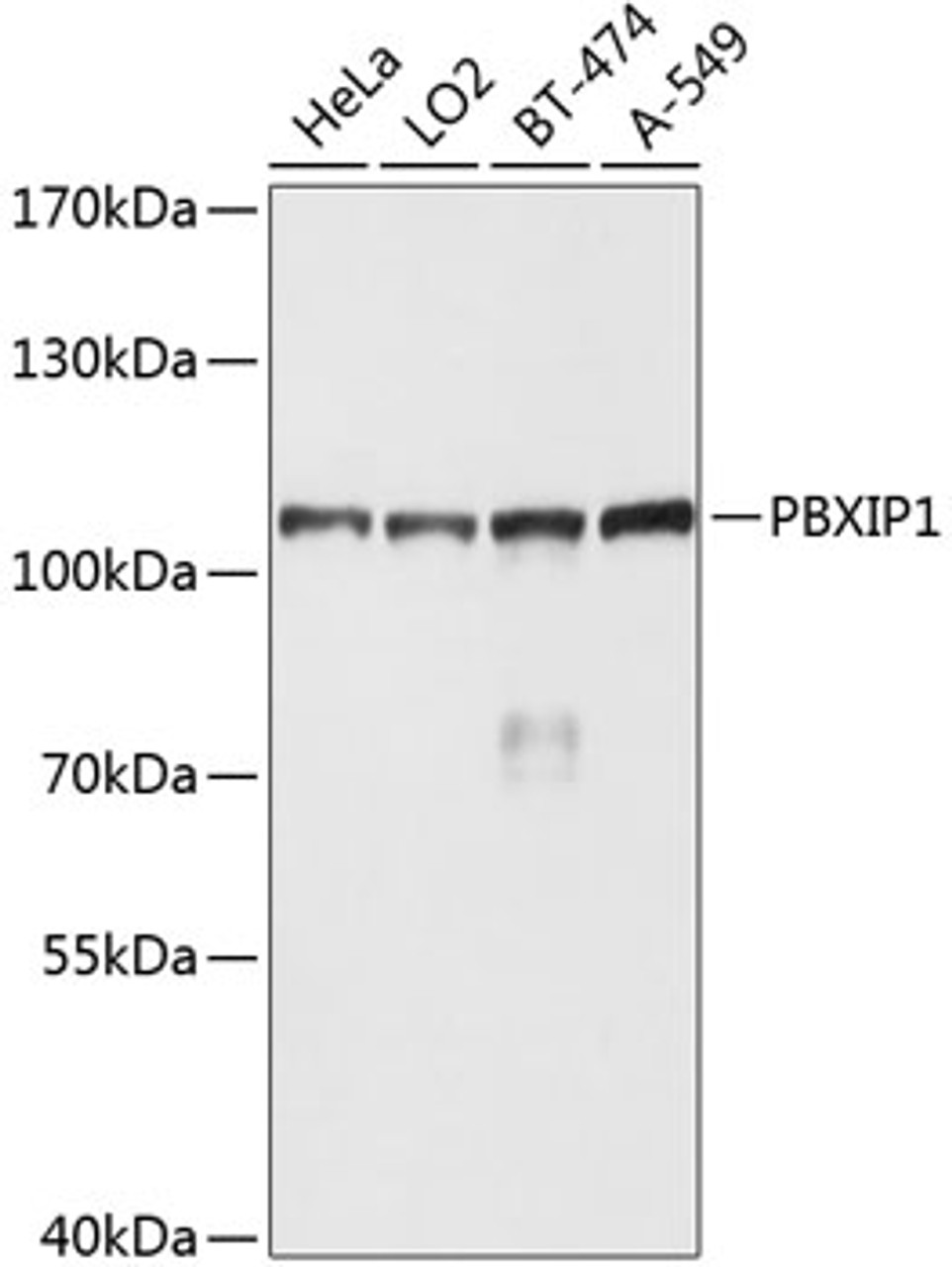 Western blot analysis of extracts of various cell lines, using PBXIP1 antibody (23-724) at 1:1000 dilution.<br/>Secondary antibody: HRP Goat Anti-Rabbit IgG (H+L) at 1:10000 dilution.<br/>Lysates/proteins: 25ug per lane.<br/>Blocking buffer: 3% nonfat dry milk in TBST.<br/>Detection: ECL Basic Kit.<br/>Exposure time: 10s.