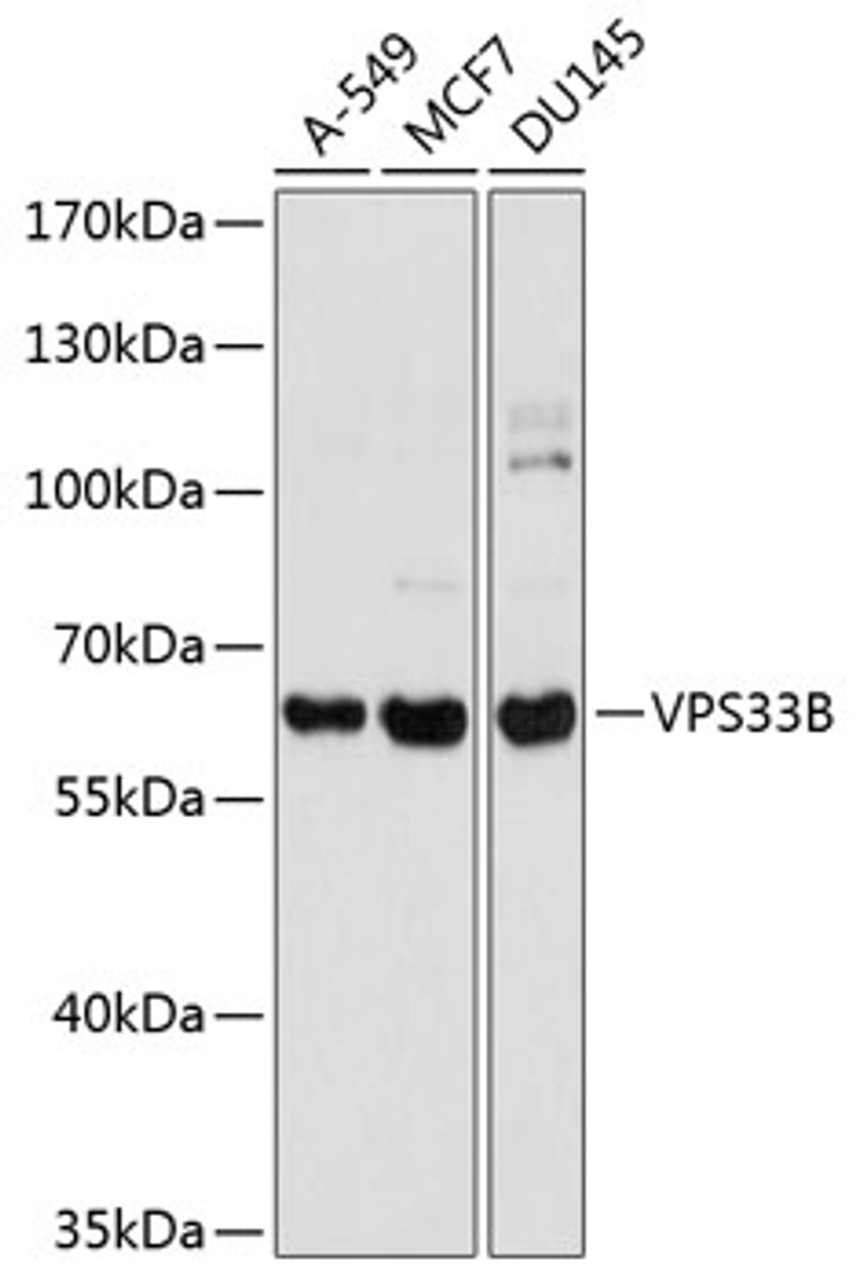 Western blot analysis of extracts of various cell lines, using VPS33B antibody (23-726) at 1:1000 dilution.<br/>Secondary antibody: HRP Goat Anti-Rabbit IgG (H+L) at 1:10000 dilution.<br/>Lysates/proteins: 25ug per lane.<br/>Blocking buffer: 3% nonfat dry milk in TBST.<br/>Detection: ECL Basic Kit.<br/>Exposure time: 1s.