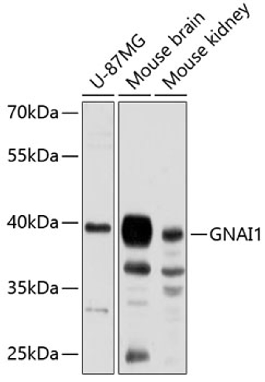 Western blot analysis of extracts of various cell lines, using GNAI1 antibody (23-741) at 1:3000 dilution.<br/>Secondary antibody: HRP Goat Anti-Rabbit IgG (H+L) at 1:10000 dilution.<br/>Lysates/proteins: 25ug per lane.<br/>Blocking buffer: 3% nonfat dry milk in TBST.<br/>Detection: ECL Basic Kit.<br/>Exposure time: 90s.