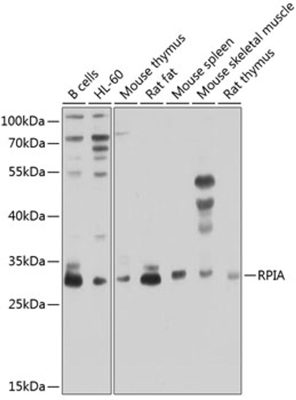 Western blot analysis of extracts of various cell lines, using RPIA antibody (23-747) at 1:1000 dilution.<br/>Secondary antibody: HRP Goat Anti-Rabbit IgG (H+L) at 1:10000 dilution.<br/>Lysates/proteins: 25ug per lane.<br/>Blocking buffer: 3% nonfat dry milk in TBST.<br/>Detection: ECL Enhanced Kit.<br/>Exposure time: 30s.