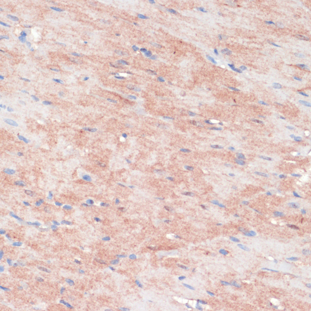 Immunohistochemistry of paraffin-embedded rat heart using RPIA antibody (23-747) at dilution of 1:100 (40x lens) .