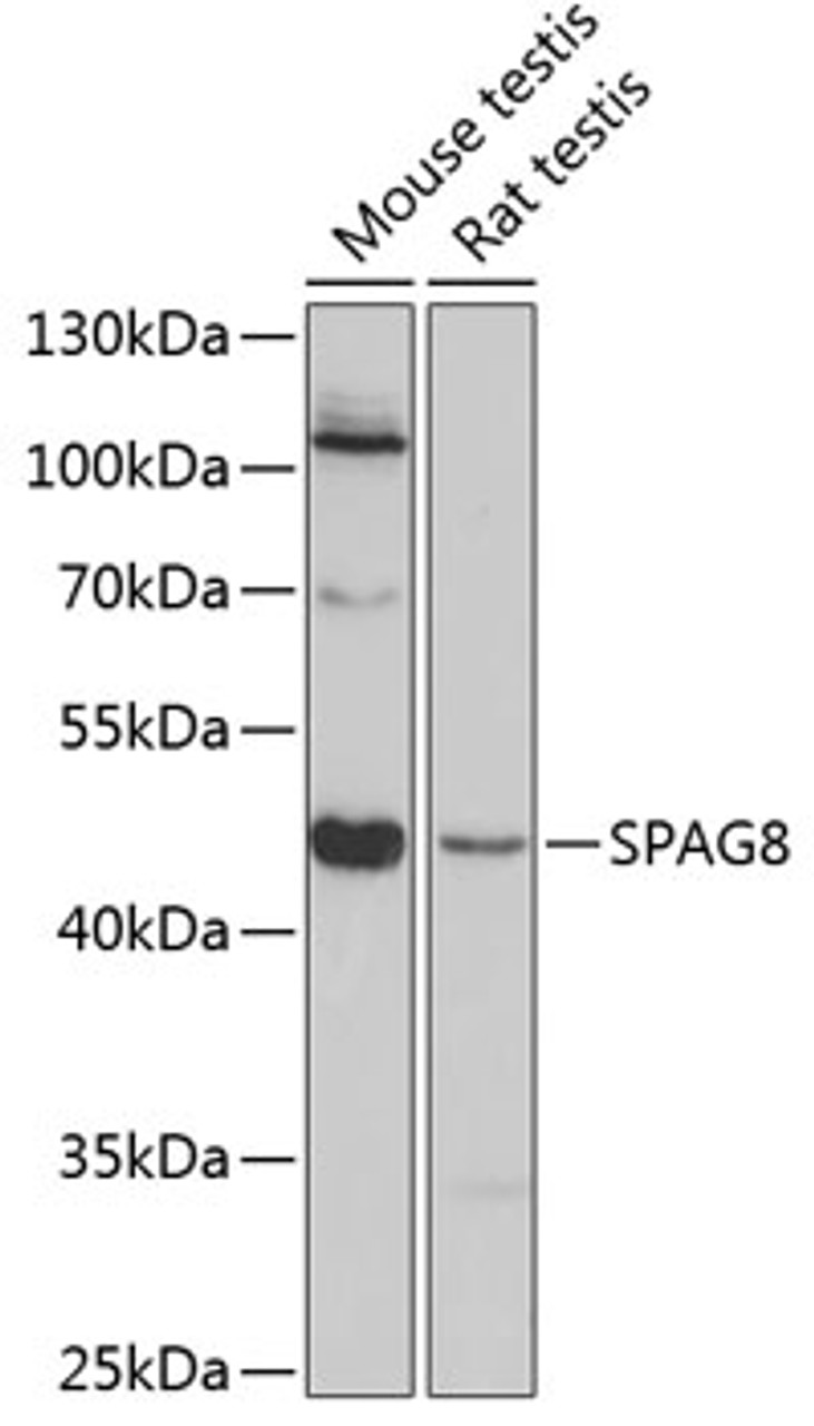 Western blot analysis of extracts of various cell lines, using SPAG8 antibody (23-762) at 1:3000 dilution.<br/>Secondary antibody: HRP Goat Anti-Rabbit IgG (H+L) at 1:10000 dilution.<br/>Lysates/proteins: 25ug per lane.<br/>Blocking buffer: 3% nonfat dry milk in TBST.<br/>Detection: ECL Basic Kit.<br/>Exposure time: 90s.