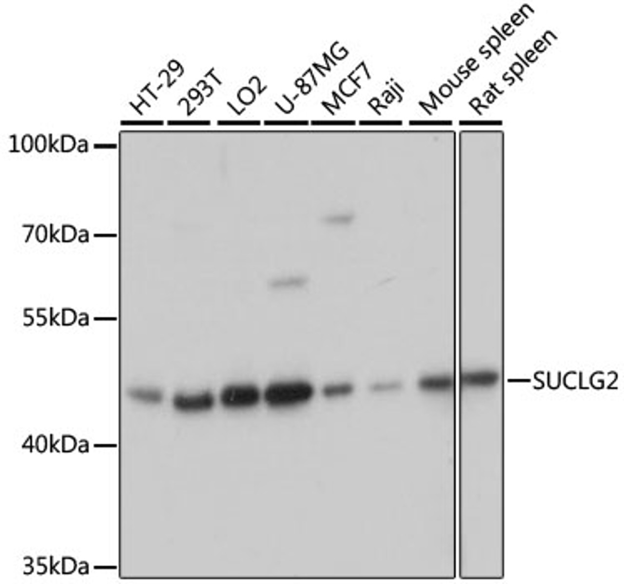 Western blot analysis of extracts of various cell lines, using SUCLG2 antibody (23-768) at 1:3000 dilution.<br/>Secondary antibody: HRP Goat Anti-Rabbit IgG (H+L) at 1:10000 dilution.<br/>Lysates/proteins: 25ug per lane.<br/>Blocking buffer: 3% nonfat dry milk in TBST.<br/>Detection: ECL Basic Kit.<br/>Exposure time: 1s.