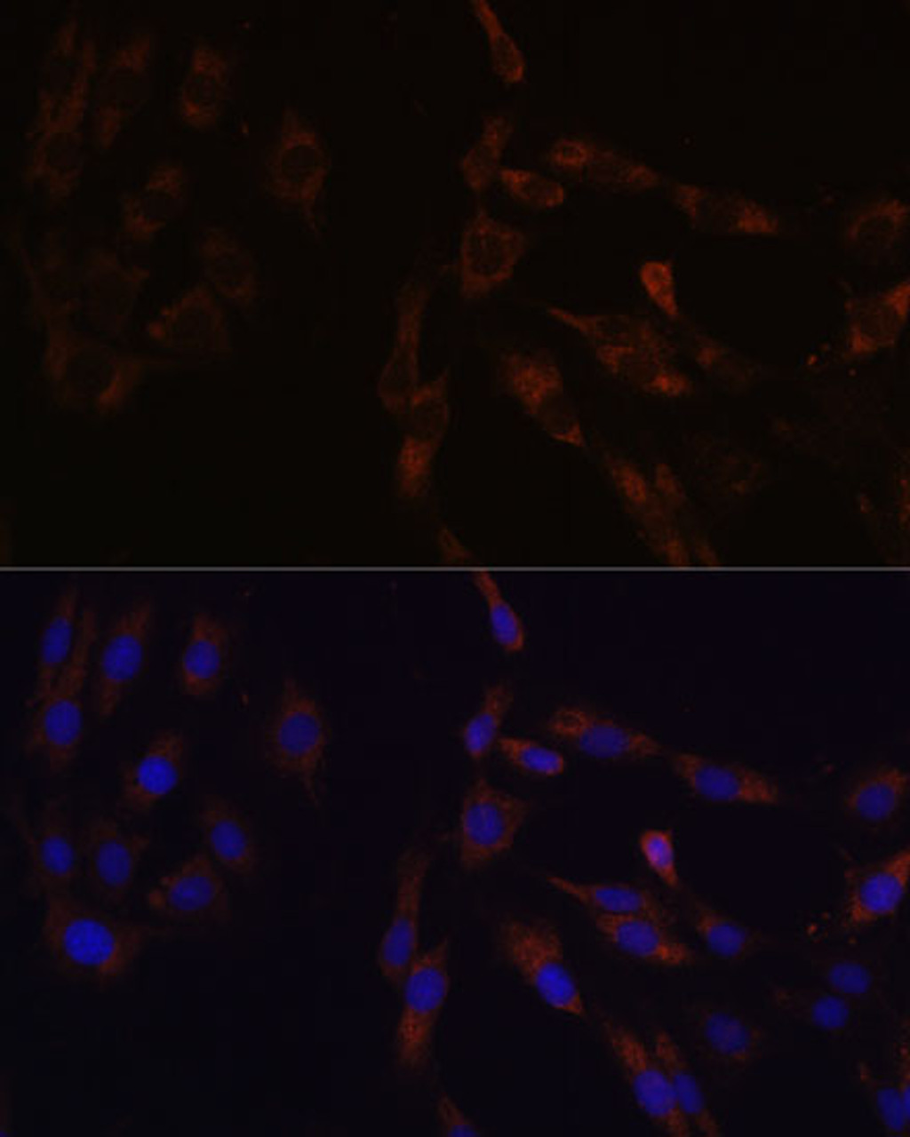 Immunofluorescence analysis of C6 cells using SUCLG2 Polyclonal Antibody (23-768) at dilution of 1:100 (40x lens) . Blue: DAPI for nuclear staining.