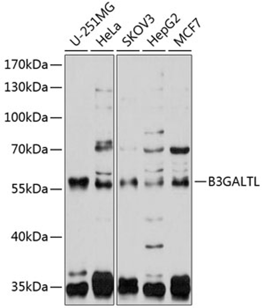 Western blot analysis of extracts of various cell lines, using B3GALTL antibody (23-774) at 1:1000 dilution.<br/>Secondary antibody: HRP Goat Anti-Rabbit IgG (H+L) at 1:10000 dilution.<br/>Lysates/proteins: 25ug per lane.<br/>Blocking buffer: 3% nonfat dry milk in TBST.<br/>Detection: ECL Basic Kit.<br/>Exposure time: 20s.