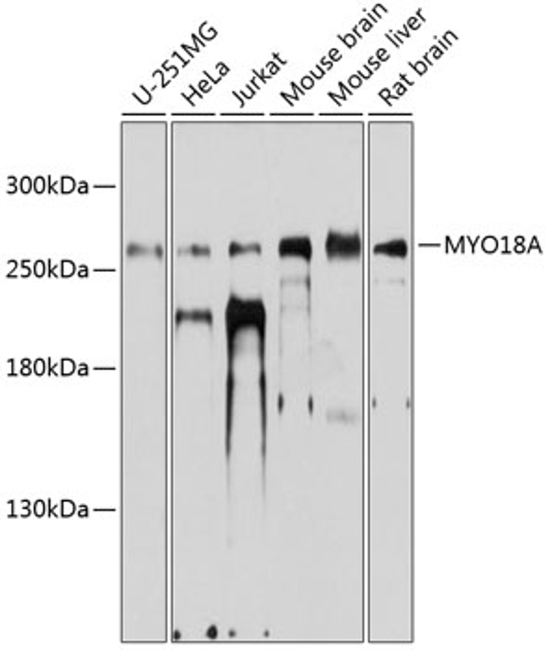 Western blot analysis of extracts of various cell lines, using MYO18A antibody (23-775) at 1:1000 dilution.<br/>Secondary antibody: HRP Goat Anti-Rabbit IgG (H+L) at 1:10000 dilution.<br/>Lysates/proteins: 25ug per lane.<br/>Blocking buffer: 3% nonfat dry milk in TBST.<br/>Detection: ECL Basic Kit.<br/>Exposure time: 10s.