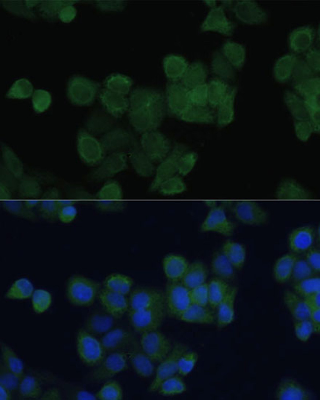 Immunofluorescence analysis of HeLa cells using ZFYVE9 antibody (23-779) at dilution of 1:100. Blue: DAPI for nuclear staining.