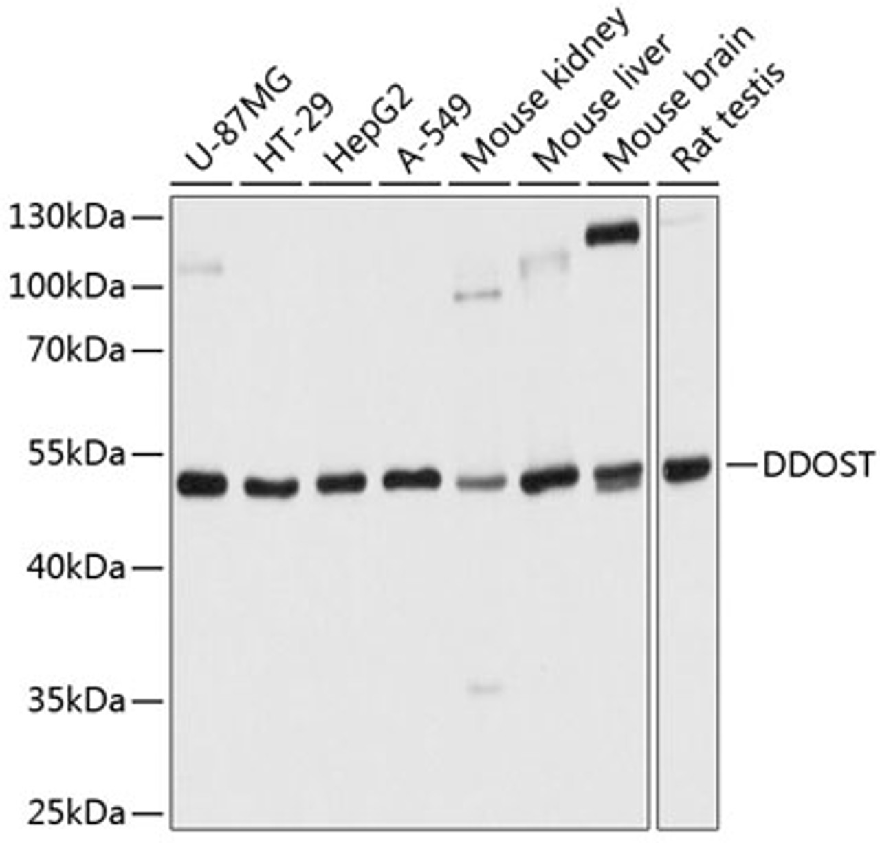 Western blot analysis of extracts of various cell lines, using DDOST antibody (23-781) at 1:1000 dilution.<br/>Secondary antibody: HRP Goat Anti-Rabbit IgG (H+L) at 1:10000 dilution.<br/>Lysates/proteins: 25ug per lane.<br/>Blocking buffer: 3% nonfat dry milk in TBST.<br/>Detection: ECL Basic Kit.<br/>Exposure time: 1s.