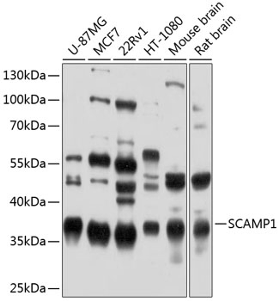 Western blot analysis of extracts of various cell lines, using SCAMP1 antibody (23-789) at 1:1000 dilution.<br/>Secondary antibody: HRP Goat Anti-Rabbit IgG (H+L) at 1:10000 dilution.<br/>Lysates/proteins: 25ug per lane.<br/>Blocking buffer: 3% nonfat dry milk in TBST.<br/>Detection: ECL Enhanced Kit.<br/>Exposure time: 1s.