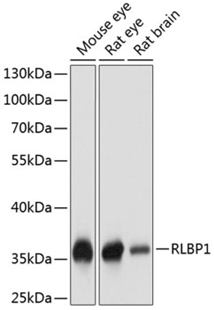 Western blot analysis of extracts of various cell lines, using RLBP1 antibody (23-790) at 1:1000 dilution.<br/>Secondary antibody: HRP Goat Anti-Rabbit IgG (H+L) at 1:10000 dilution.<br/>Lysates/proteins: 25ug per lane.<br/>Blocking buffer: 3% nonfat dry milk in TBST.<br/>Detection: ECL Basic Kit.<br/>Exposure time: 1s.