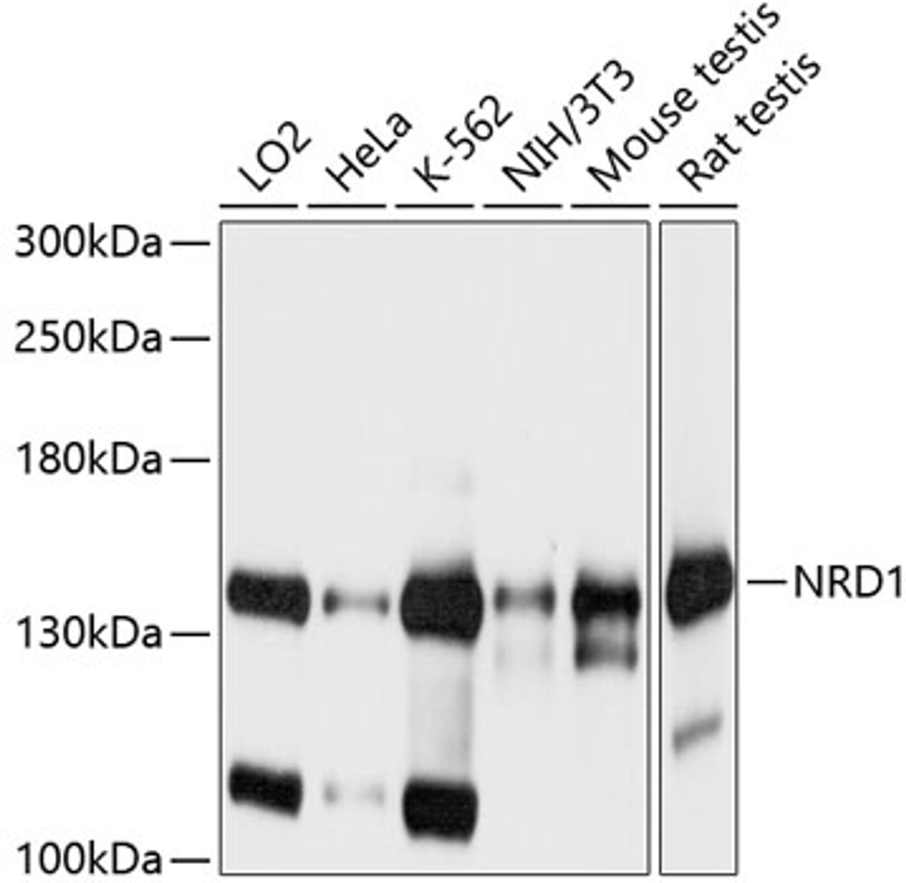 Western blot analysis of extracts of various cell lines, using NRD1 antibody (23-797) at 1:1000 dilution.<br/>Secondary antibody: HRP Goat Anti-Rabbit IgG (H+L) at 1:10000 dilution.<br/>Lysates/proteins: 25ug per lane.<br/>Blocking buffer: 3% nonfat dry milk in TBST.<br/>Detection: ECL Basic Kit.<br/>Exposure time: 1s.