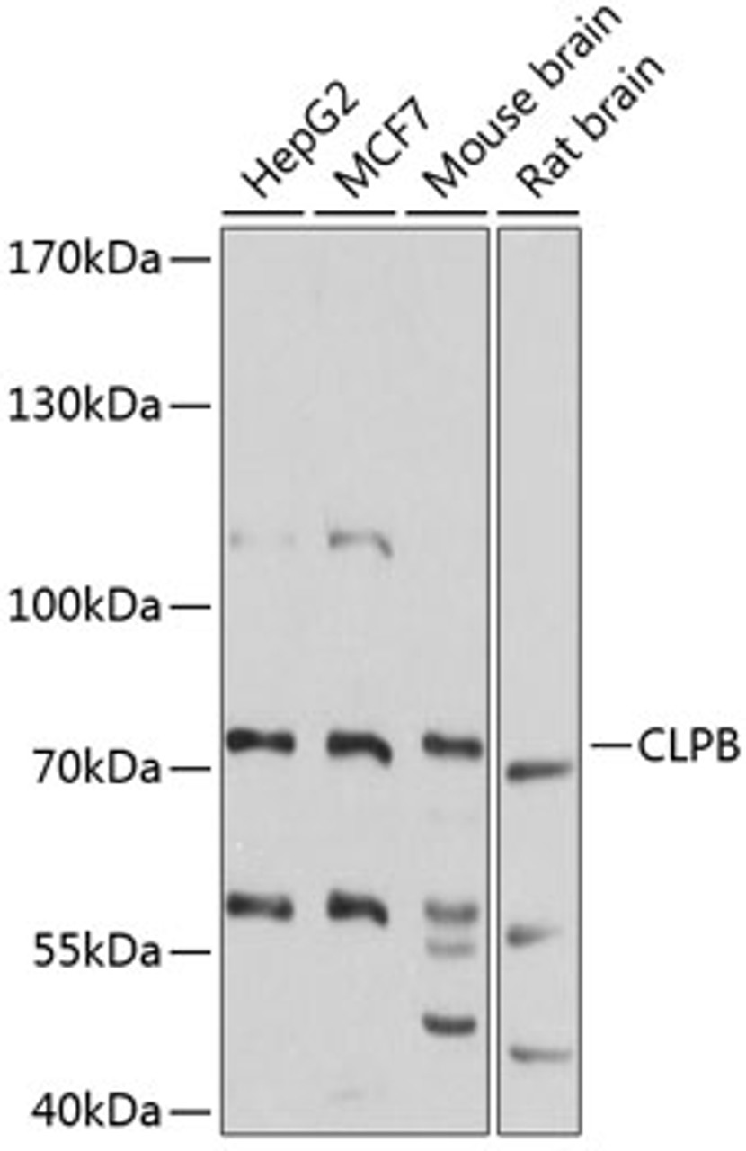 Western blot analysis of extracts of various cell lines, using CLPB antibody (23-800) at 1:3000 dilution.<br/>Secondary antibody: HRP Goat Anti-Rabbit IgG (H+L) at 1:10000 dilution.<br/>Lysates/proteins: 25ug per lane.<br/>Blocking buffer: 3% nonfat dry milk in TBST.<br/>Detection: ECL Basic Kit.<br/>Exposure time: 5s.