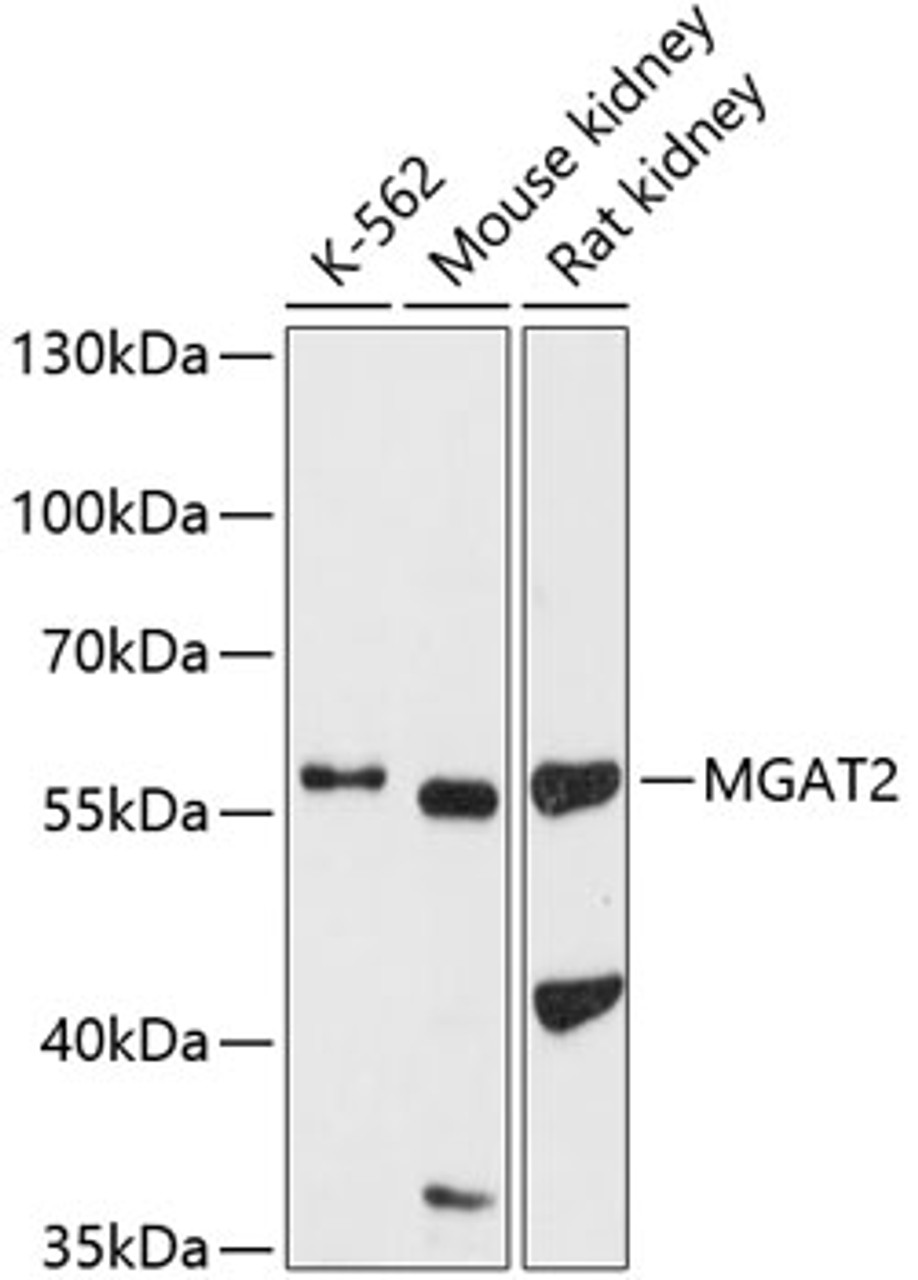 Western blot analysis of extracts of various cell lines, using MGAT2 antibody (23-801) at 1:1000 dilution.<br/>Secondary antibody: HRP Goat Anti-Rabbit IgG (H+L) at 1:10000 dilution.<br/>Lysates/proteins: 25ug per lane.<br/>Blocking buffer: 3% nonfat dry milk in TBST.<br/>Detection: ECL Basic Kit.<br/>Exposure time: 90s.