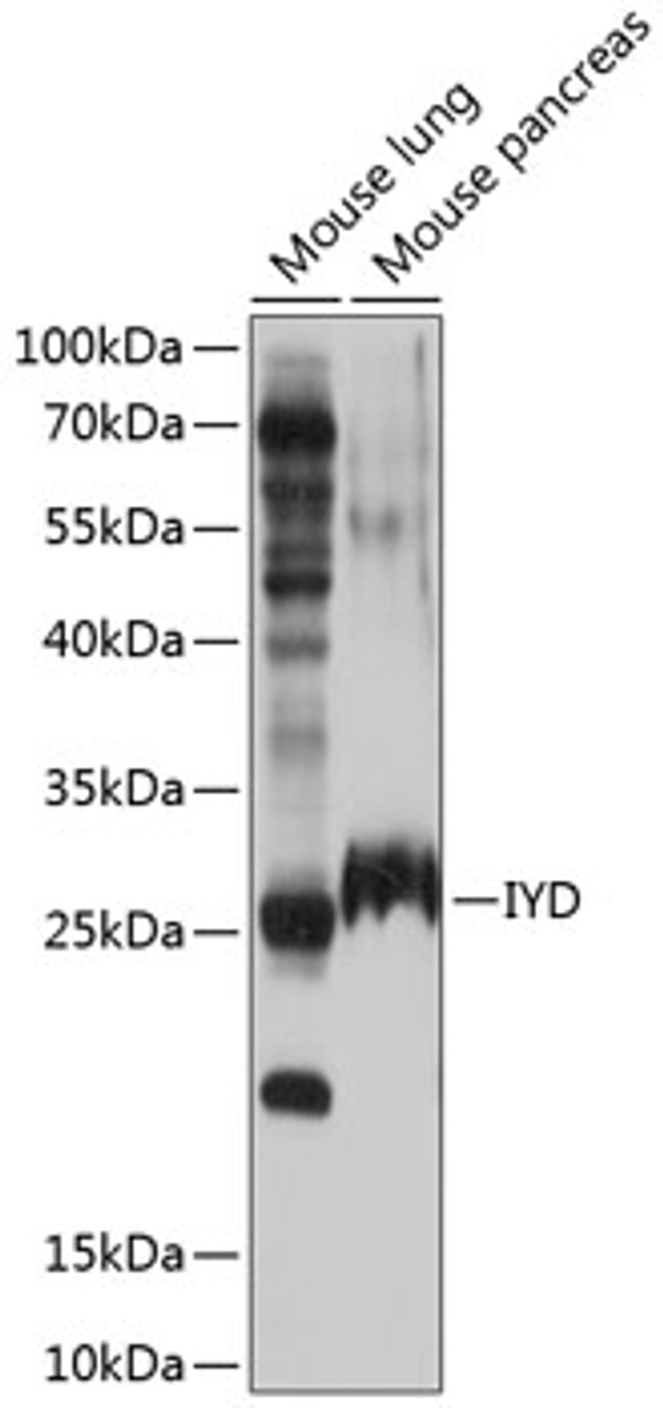 Western blot analysis of extracts of various cell lines, using IYD antibody (23-810) at 1:1000 dilution.<br/>Secondary antibody: HRP Goat Anti-Rabbit IgG (H+L) at 1:10000 dilution.<br/>Lysates/proteins: 25ug per lane.<br/>Blocking buffer: 3% nonfat dry milk in TBST.<br/>Detection: ECL Basic Kit.<br/>Exposure time: 10s.