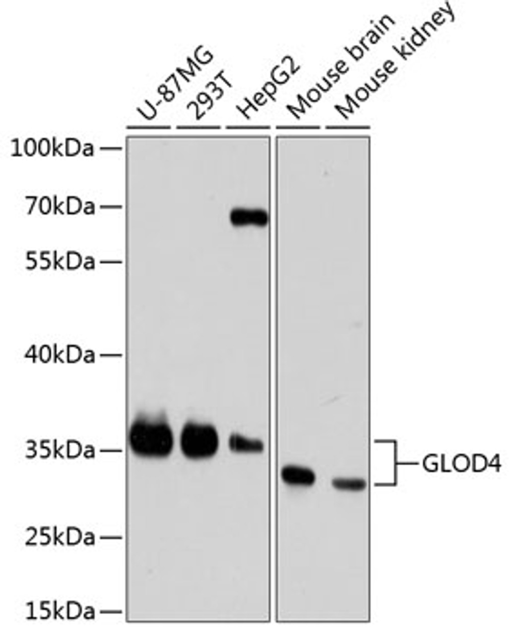 Western blot analysis of extracts of various cell lines, using GLOD4 antibody (23-814) at 1:3000 dilution.<br/>Secondary antibody: HRP Goat Anti-Rabbit IgG (H+L) at 1:10000 dilution.<br/>Lysates/proteins: 25ug per lane.<br/>Blocking buffer: 3% nonfat dry milk in TBST.<br/>Detection: ECL Basic Kit.<br/>Exposure time: 90s.