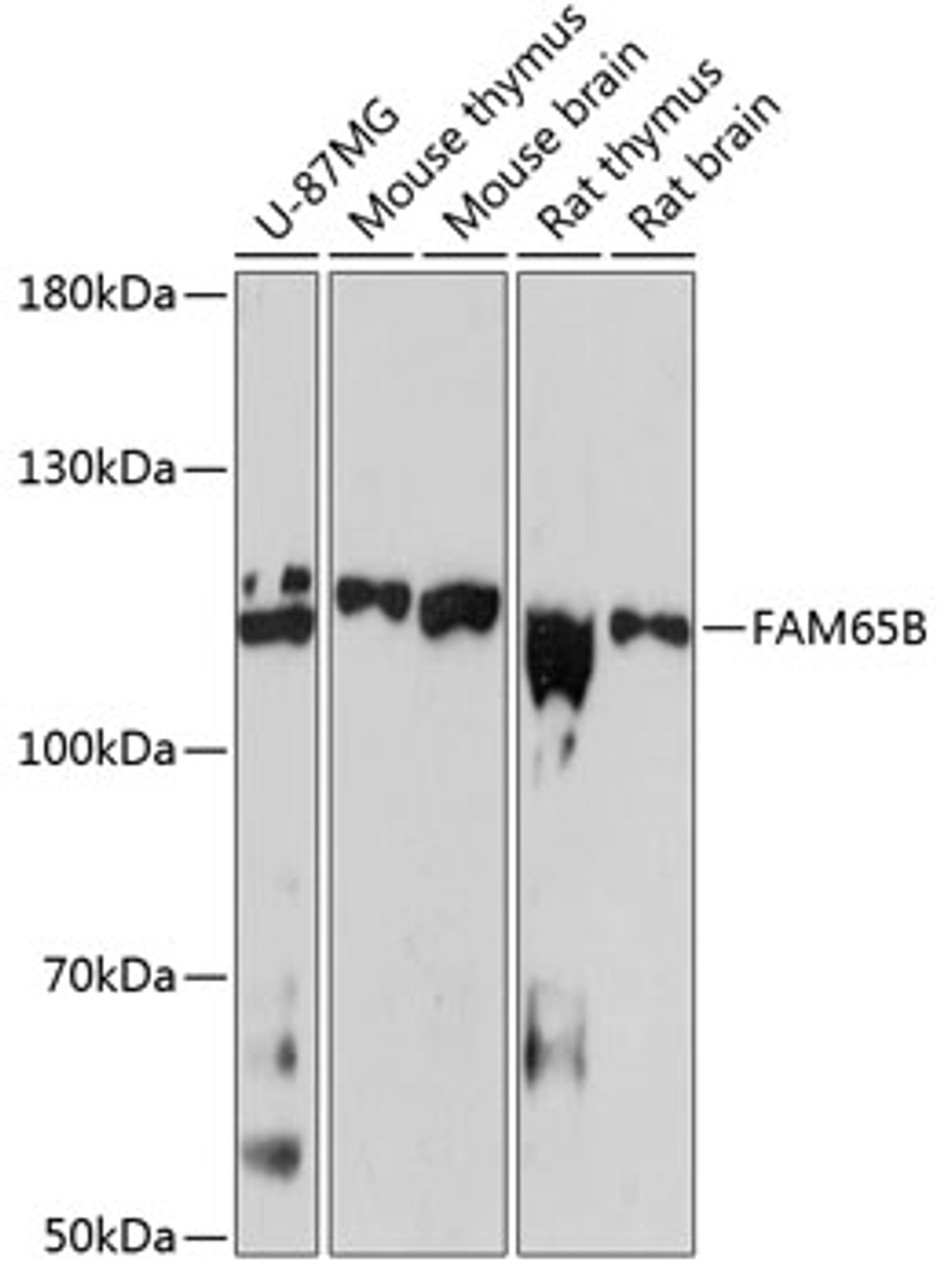 Western blot analysis of extracts of various cell lines, using FAM65B antibody (23-819) at 1:3000 dilution.<br/>Secondary antibody: HRP Goat Anti-Rabbit IgG (H+L) at 1:10000 dilution.<br/>Lysates/proteins: 25ug per lane.<br/>Blocking buffer: 3% nonfat dry milk in TBST.<br/>Detection: ECL Basic Kit.<br/>Exposure time: 90s.