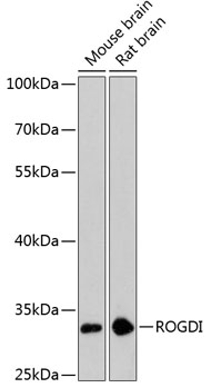 Western blot analysis of extracts of various cell lines, using ROGDI antibody (23-820) at 1:3000 dilution.<br/>Secondary antibody: HRP Goat Anti-Rabbit IgG (H+L) at 1:10000 dilution.<br/>Lysates/proteins: 25ug per lane.<br/>Blocking buffer: 3% nonfat dry milk in TBST.<br/>Detection: ECL Basic Kit.<br/>Exposure time: 90s.
