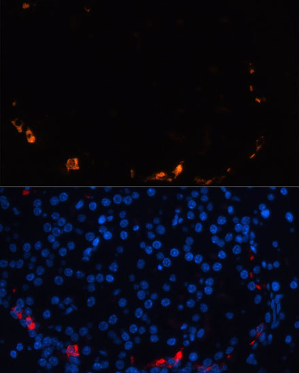 Immunofluorescence analysis of rat pancreas using SST Polyclonal Antibody (23-824) at dilution of 1:100 (40x lens) . Blue: DAPI for nuclear staining.
