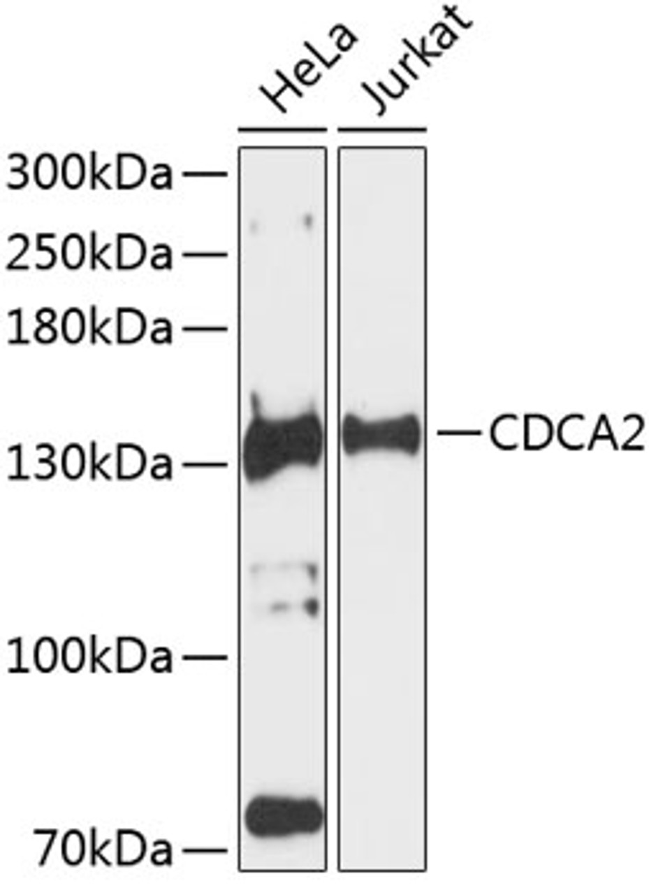 Western blot analysis of extracts of various cell lines, using CDCA2 antibody (23-833) at 1:3000 dilution.<br/>Secondary antibody: HRP Goat Anti-Rabbit IgG (H+L) at 1:10000 dilution.<br/>Lysates/proteins: 25ug per lane.<br/>Blocking buffer: 3% nonfat dry milk in TBST.<br/>Detection: ECL Basic Kit.<br/>Exposure time: 90s.