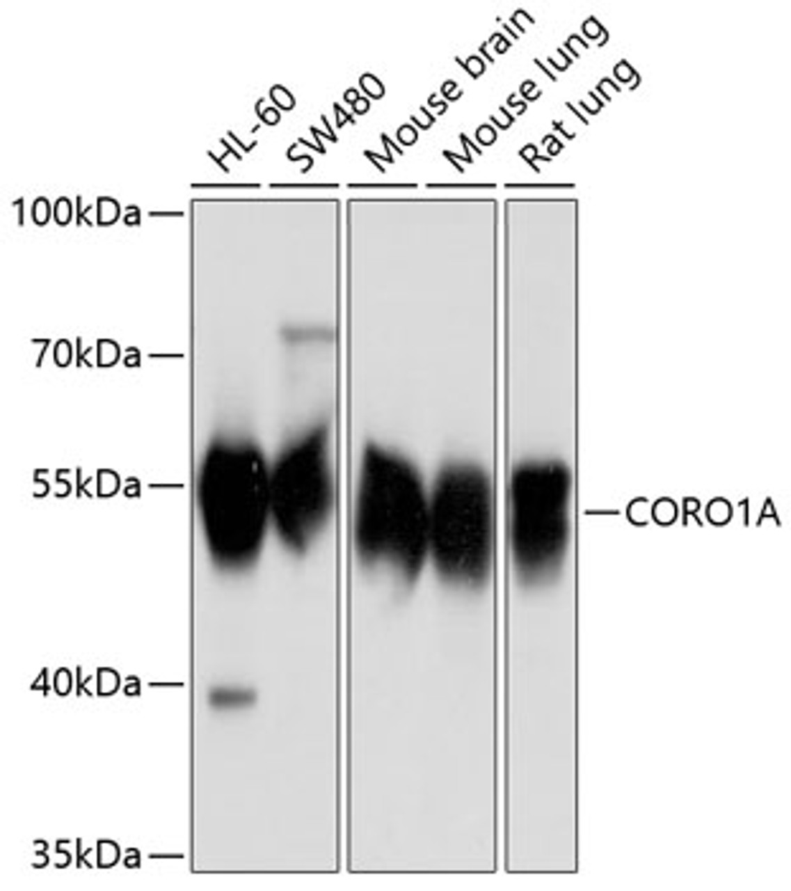 Western blot analysis of extracts of various cell lines, using CORO1A antibody (23-837) at 1:1000 dilution.<br/>Secondary antibody: HRP Goat Anti-Rabbit IgG (H+L) at 1:10000 dilution.<br/>Lysates/proteins: 25ug per lane.<br/>Blocking buffer: 3% nonfat dry milk in TBST.<br/>Detection: ECL Basic Kit.<br/>Exposure time: 1s.