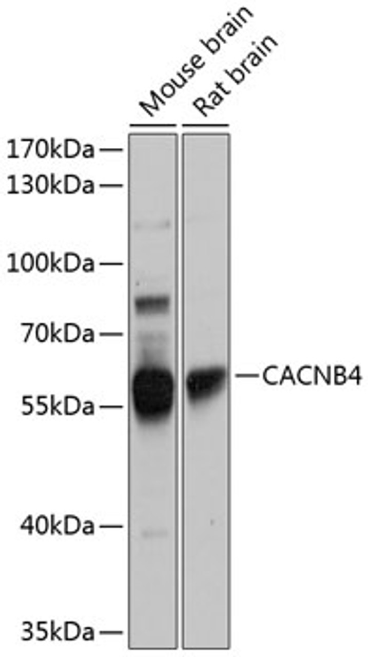 Western blot analysis of extracts of various cell lines, using CACNB4 antibody (23-838) at 1:1000 dilution.<br/>Secondary antibody: HRP Goat Anti-Rabbit IgG (H+L) at 1:10000 dilution.<br/>Lysates/proteins: 25ug per lane.<br/>Blocking buffer: 3% nonfat dry milk in TBST.<br/>Detection: ECL Basic Kit.<br/>Exposure time: 1s.
