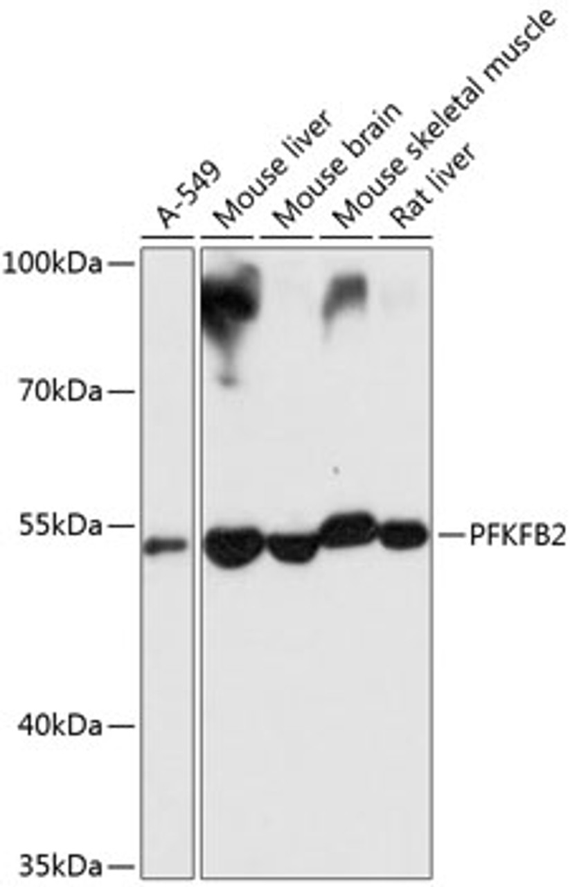 Western blot analysis of extracts of various cell lines, using PFKFB2 antibody (23-840) at 1:1000 dilution.<br/>Secondary antibody: HRP Goat Anti-Rabbit IgG (H+L) at 1:10000 dilution.<br/>Lysates/proteins: 25ug per lane.<br/>Blocking buffer: 3% nonfat dry milk in TBST.<br/>Detection: ECL Basic Kit.<br/>Exposure time: 10s.