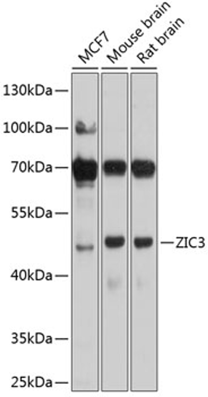 Western blot analysis of extracts of various cell lines, using ZIC3 antibody (23-866) at 1:1000 dilution.<br/>Secondary antibody: HRP Goat Anti-Rabbit IgG (H+L) at 1:10000 dilution.<br/>Lysates/proteins: 25ug per lane.<br/>Blocking buffer: 3% nonfat dry milk in TBST.<br/>Detection: ECL Basic Kit.<br/>Exposure time: 10s.