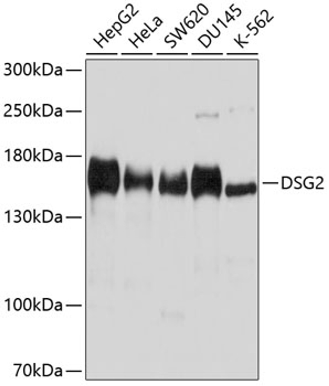 Western blot analysis of extracts of various cell lines, using DSG2 antibody (23-867) at 1:1000 dilution.<br/>Secondary antibody: HRP Goat Anti-Rabbit IgG (H+L) at 1:10000 dilution.<br/>Lysates/proteins: 25ug per lane.<br/>Blocking buffer: 3% nonfat dry milk in TBST.<br/>Detection: ECL Basic Kit.<br/>Exposure time: 10s.