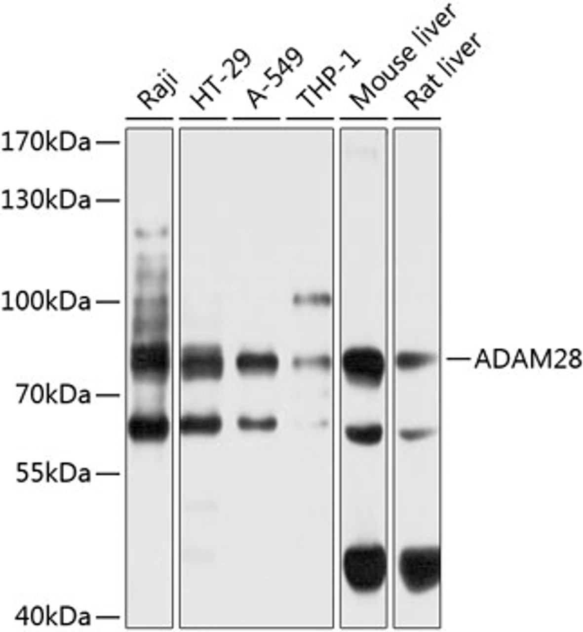 Western blot analysis of extracts of various cell lines, using ADAM28 antibody (23-875) at 1:1000 dilution.<br/>Secondary antibody: HRP Goat Anti-Rabbit IgG (H+L) at 1:10000 dilution.<br/>Lysates/proteins: 25ug per lane.<br/>Blocking buffer: 3% nonfat dry milk in TBST.<br/>Detection: ECL Basic Kit.<br/>Exposure time: 5s.