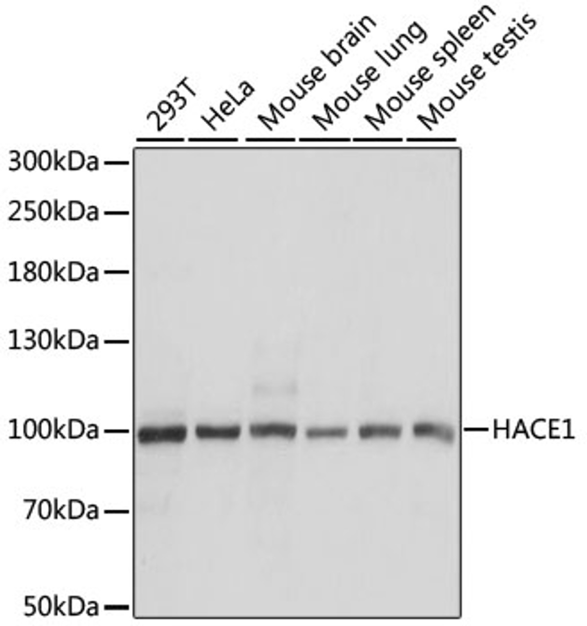 Western blot analysis of extracts of various cell lines, using HACE1 antibody (23-886) at 1:1000 dilution.<br/>Secondary antibody: HRP Goat Anti-Rabbit IgG (H+L) at 1:10000 dilution.<br/>Lysates/proteins: 25ug per lane.<br/>Blocking buffer: 3% nonfat dry milk in TBST.<br/>Detection: ECL Basic Kit.<br/>Exposure time: 10s.