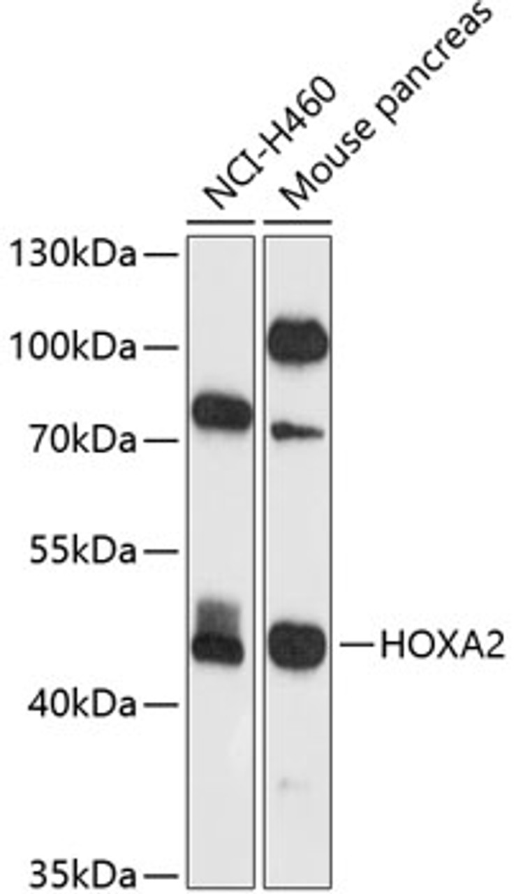 Western blot analysis of extracts of various cell lines, using HOXA2 antibody (23-891) at 1:1000 dilution.<br/>Secondary antibody: HRP Goat Anti-Rabbit IgG (H+L) at 1:10000 dilution.<br/>Lysates/proteins: 25ug per lane.<br/>Blocking buffer: 3% nonfat dry milk in TBST.<br/>Detection: ECL Basic Kit.<br/>Exposure time: 30s.