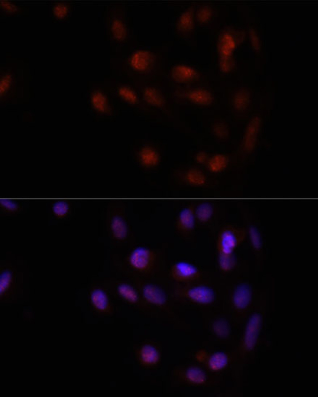 Immunofluorescence analysis of U2OS cells using HOXA2 antibody (23-891) at dilution of 1:100. Blue: DAPI for nuclear staining.